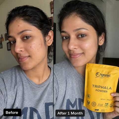 Pimple and Acne results with Triphala