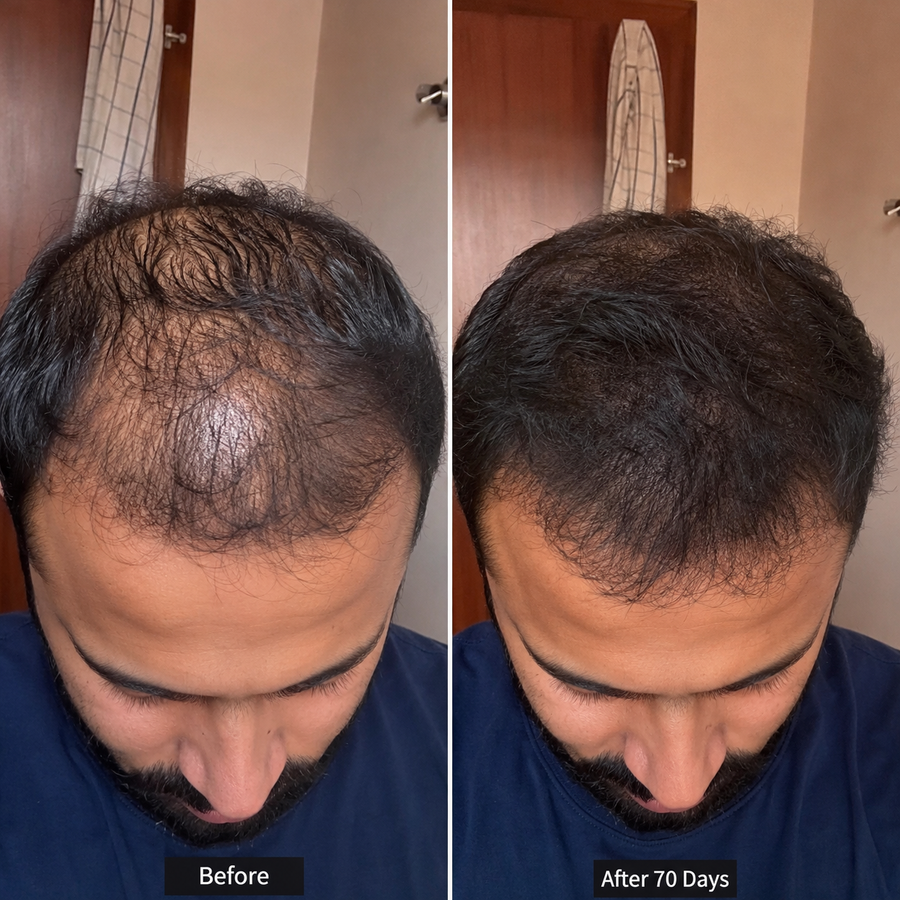 Hair Growth & Energy Boost in Just 70 Days