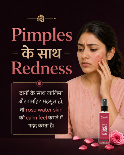 Rose water problem card