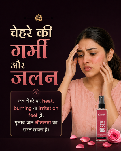 Rose water problem card